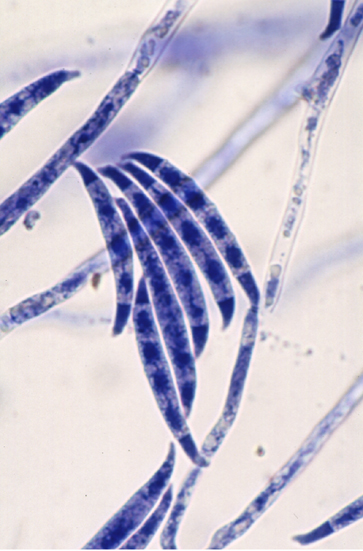 Spores de Fusarium graminaerum ©​​​​​​​ UR MycSA