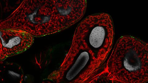 Glande salivaire de cicadelle (Euscelidius variegatus) infectée par le phytoplasme de la flavescence dorée © Nathalie Bouvery/UMR BFP