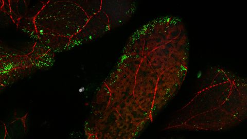 Glande salivaire de cicadelle (Euscelidius variegatus) infectée par le phytoplasme de la flavescence dorée #2 © Nathalie Bouvery/UMR BFP