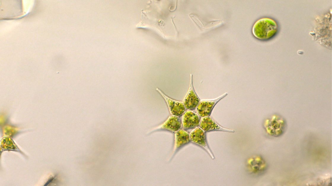 Monactinus simplex, plancton de lac Aquitain :: Département Sciences ...