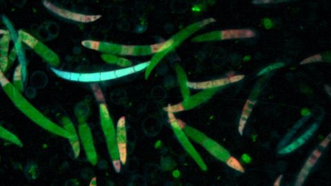 Spores de Fusarium graminearum, champignon  pathogène du blé © Laetitia Pinson-Gadais /UR MycSA